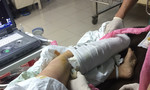 TP.HCM: Bệnh viện quận 11 cứu thành công người phụ nữ bị từ chối phẫu thuật trước đó