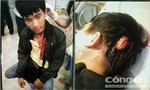 Truy hô 'cướp', một thanh niên bị đánh nhập viện