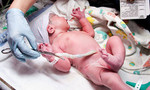 Bác sĩ chia sẻ những điều kỳ diệu về dây rốn của trẻ sơ sinh