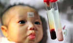 Nhiều người Việt mang gen bệnh Thalassemia nhưng không biết