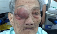 Mẹ Việt Nam anh hùng 101 tuổi vượt qua ca mổ u khủng ở hốc mắt