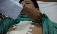 Sau chầu nhậu, nam thanh niên nhập viện cấp cứu vì thủng tim