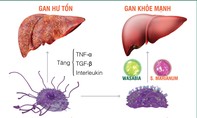 Phát hiện mới về tế bào Kupffer - Tác nhân quan trọng gây suy gan