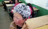 Cậu bé 'mái tóc băng' ở Trung Quốc được hỗ trợ hàng triệu USD