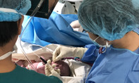 20 y bác sĩ cứu sống bé song thai bị bệnh lý tim ngay khi chào đời