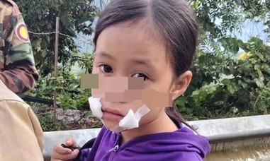 Bé gái 9 tuổi bán hàng ven đường bị cướp tấn công, dao cứa rách miệng